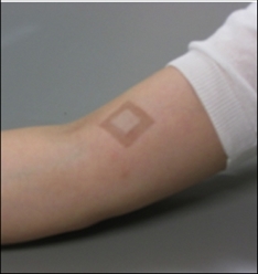 アルコールパッチテスト